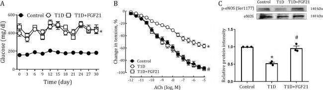 Phospho-eNOS (Ser1177) Antibody in Western Blot (WB)