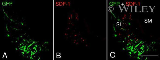 CXCL12 beta (SDF-1 beta) Antibody in Immunohistochemistry (IHC)