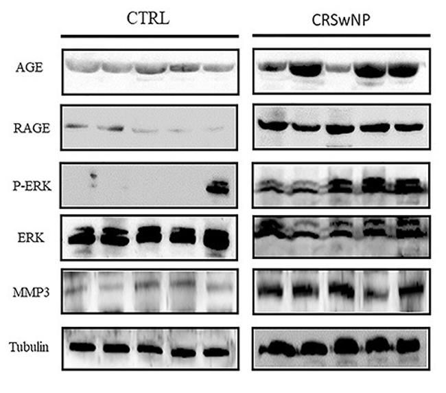 RAGE Antibody in Western Blot (WB)