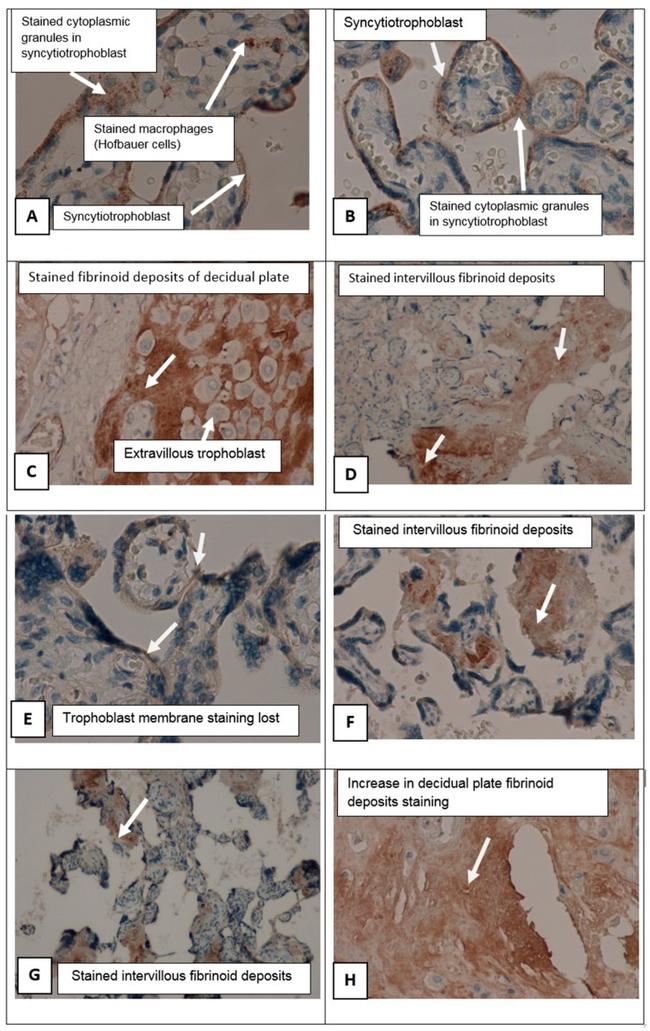 alpha-1 Antitrypsin Antibody in Immunohistochemistry, Immunohistochemistry (Paraffin) (IHC, IHC (P))