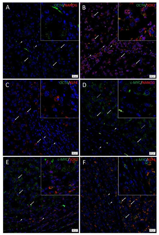 SOX2 Antibody in Immunohistochemistry (IHC)