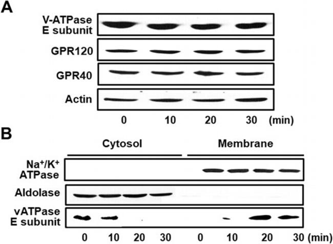 V-ATPase E1 Antibody in Western Blot (WB)