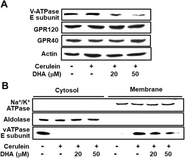 V-ATPase E1 Antibody in Western Blot (WB)