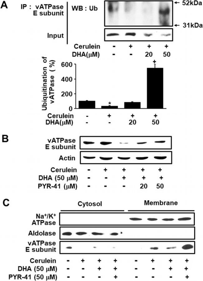 V-ATPase E1 Antibody in Western Blot (WB)