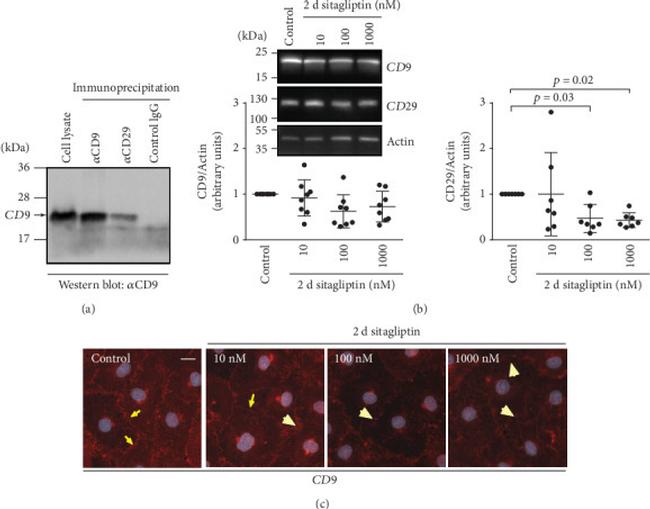 CD29 (Integrin beta 1) Antibody in Western Blot (WB)