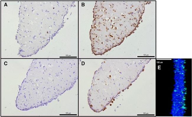 CD68 Antibody in Immunohistochemistry (IHC)