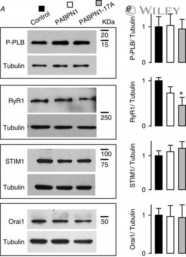 beta Tubulin Antibody in Western Blot (WB)